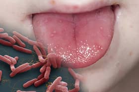 THE UBIQUITOUS GERMS