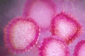 Sewage may help detect Covid-19 asymptomatic cases