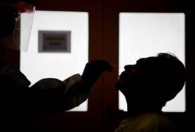 Capacity of Covid-19 labs expected to increase — Adham Baba