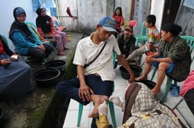 Stigma against leprosy contributes to spread of the disease — Dr Noor Hisham