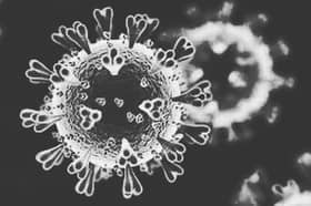 Covid-19 : Omicron BA.5 variant likely to cause increase in cases — Khairy