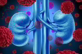 Derma buah pinggang demi melihat orang lain kembali sihat, sanggupkah anda?