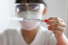 Researchers: Cancer cases in younger people on the rise globally