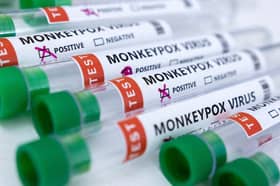 New York City declares public health emergency over monkeypox