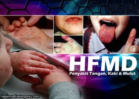 HFMD: Sikap ibu bapa, pusat jagaan kanak-kanak padat punca kes naik