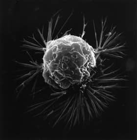 Cancer fourth leading cause of death nationwide