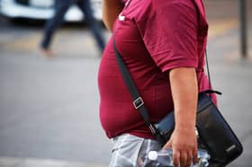 Non-surgery options now available for obese Malaysians