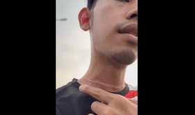 Leher penunggang motor cedera terkena tali layang-layang di Kepong