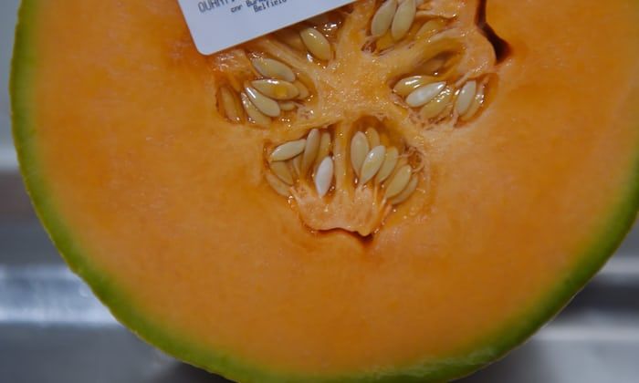 2 rakyat Singapura dijangkiti bakteria listeria dari Australia