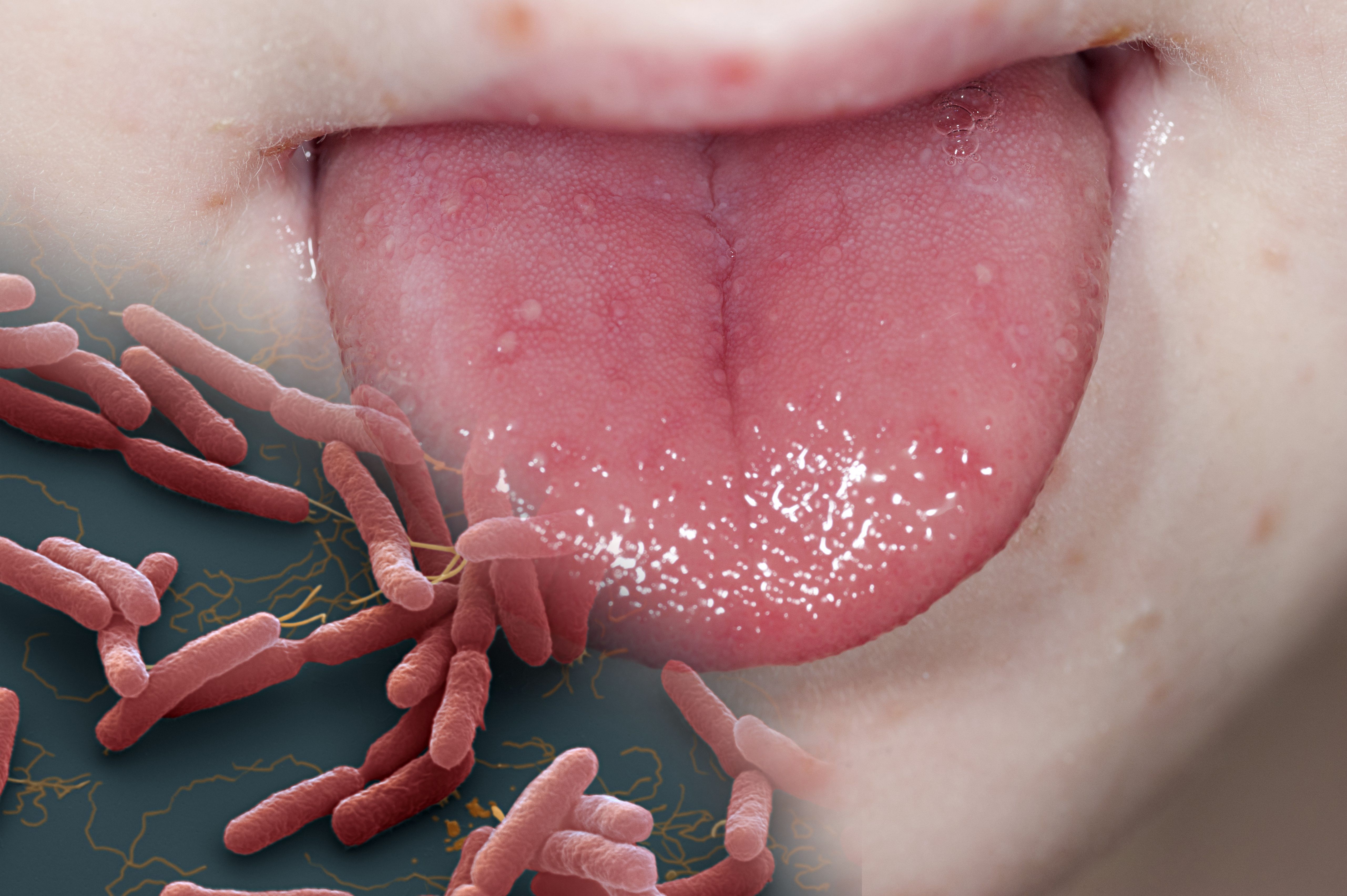 THE UBIQUITOUS GERMS