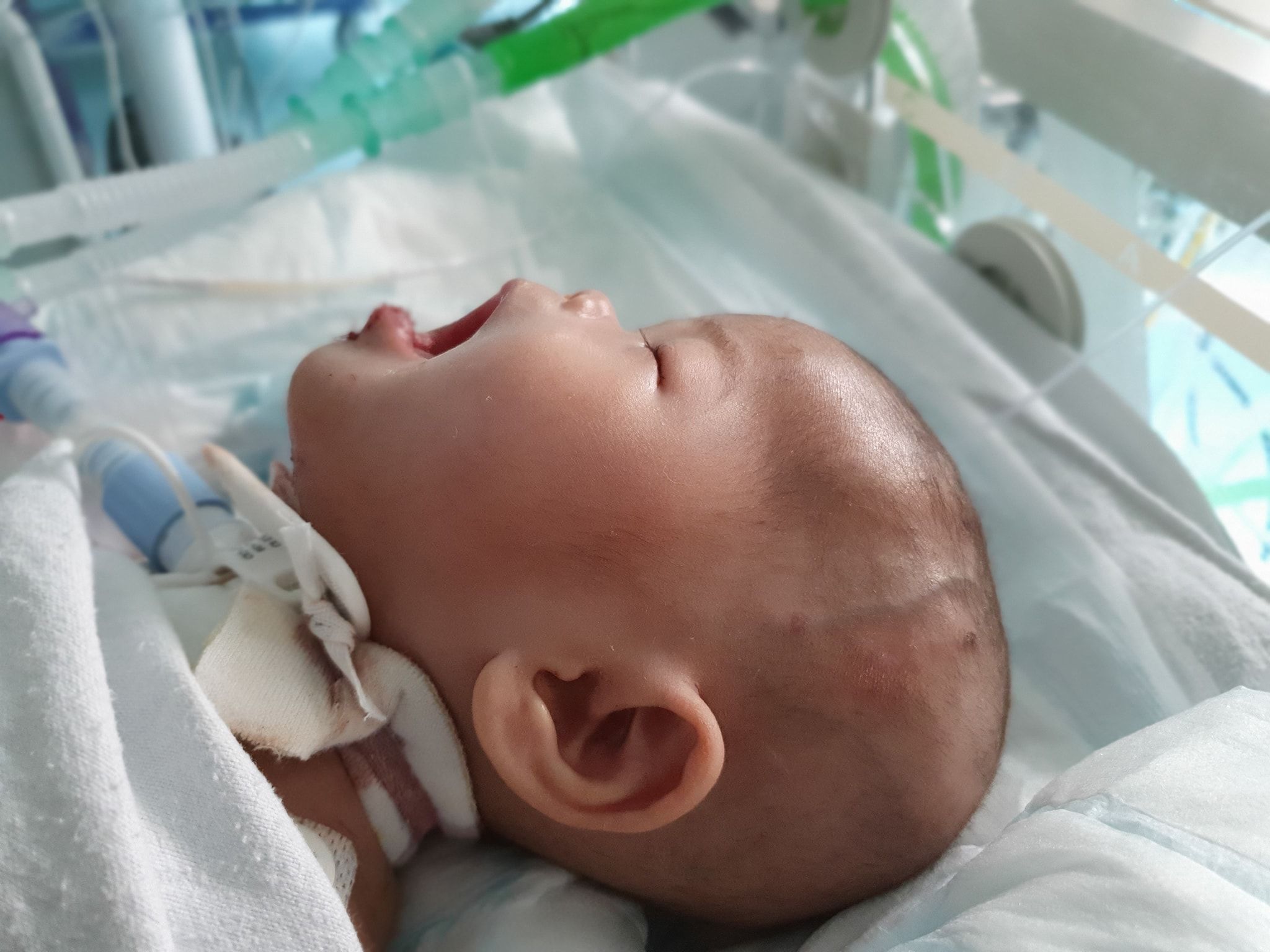 EXCO zahir penghargaan Ainul Mardhiah berjaya dibedah