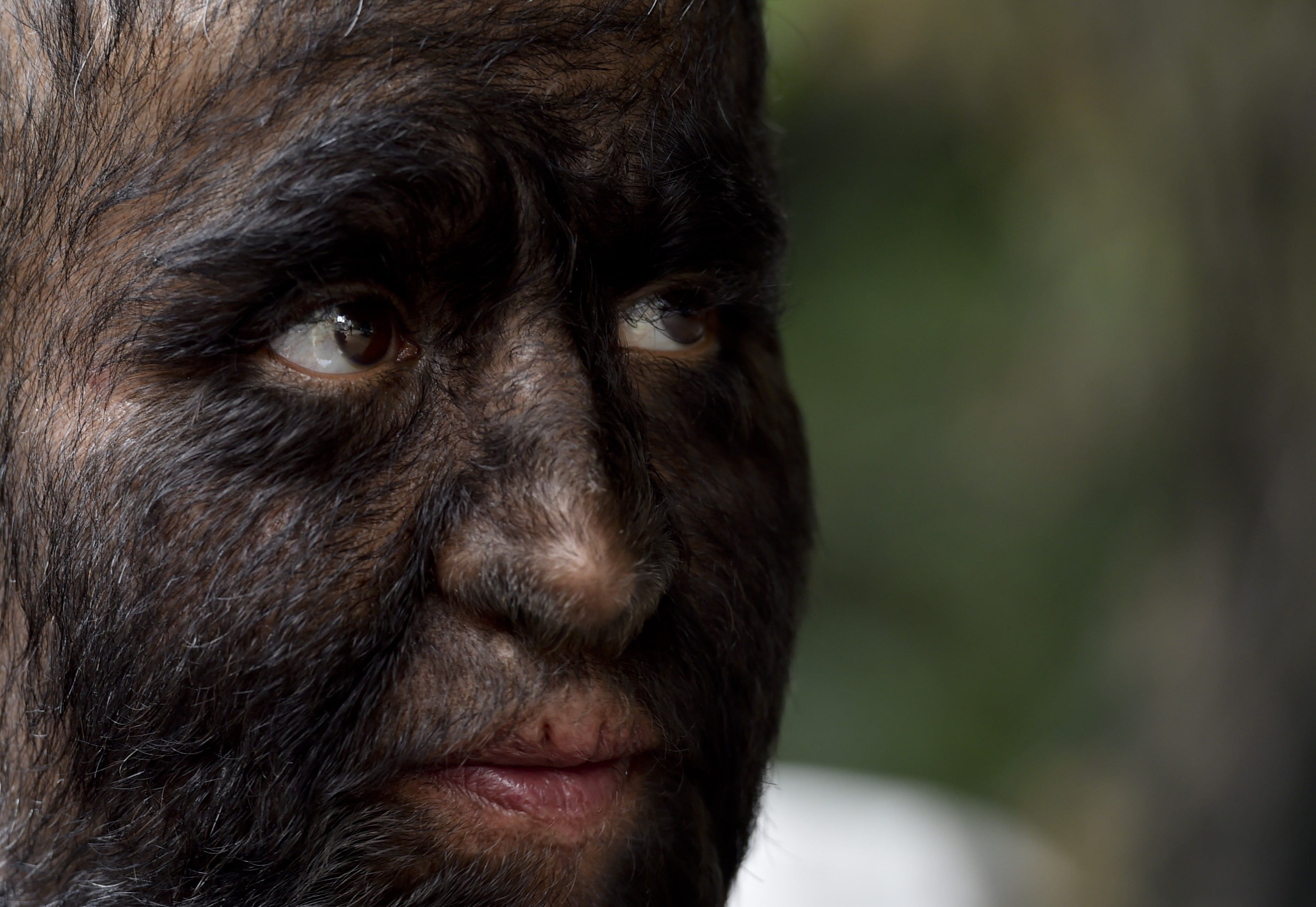 Angkara susu tercemar, 16 budak jadi `serigala jadian'