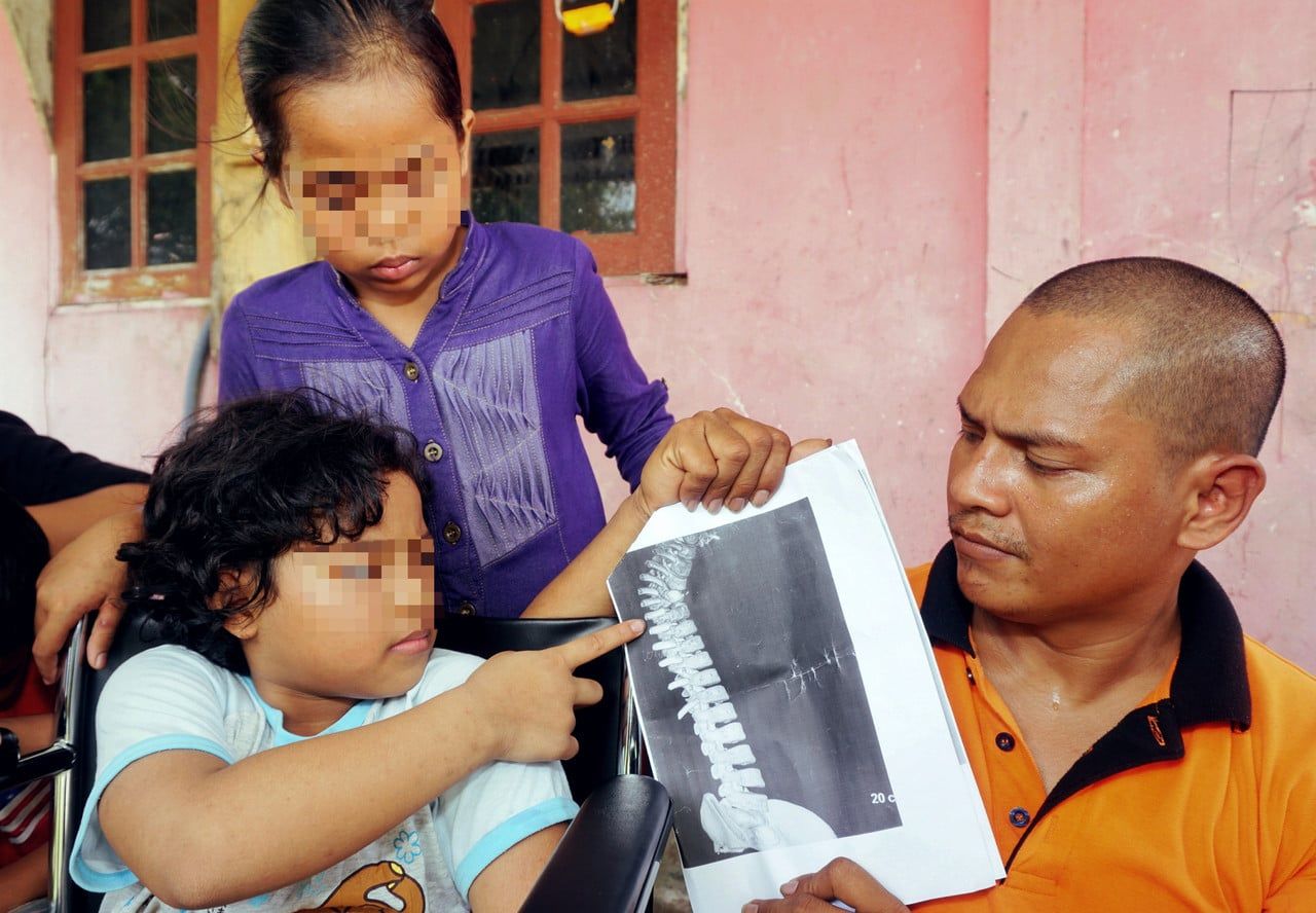 Dibuli hingga bengkok tulang belakang