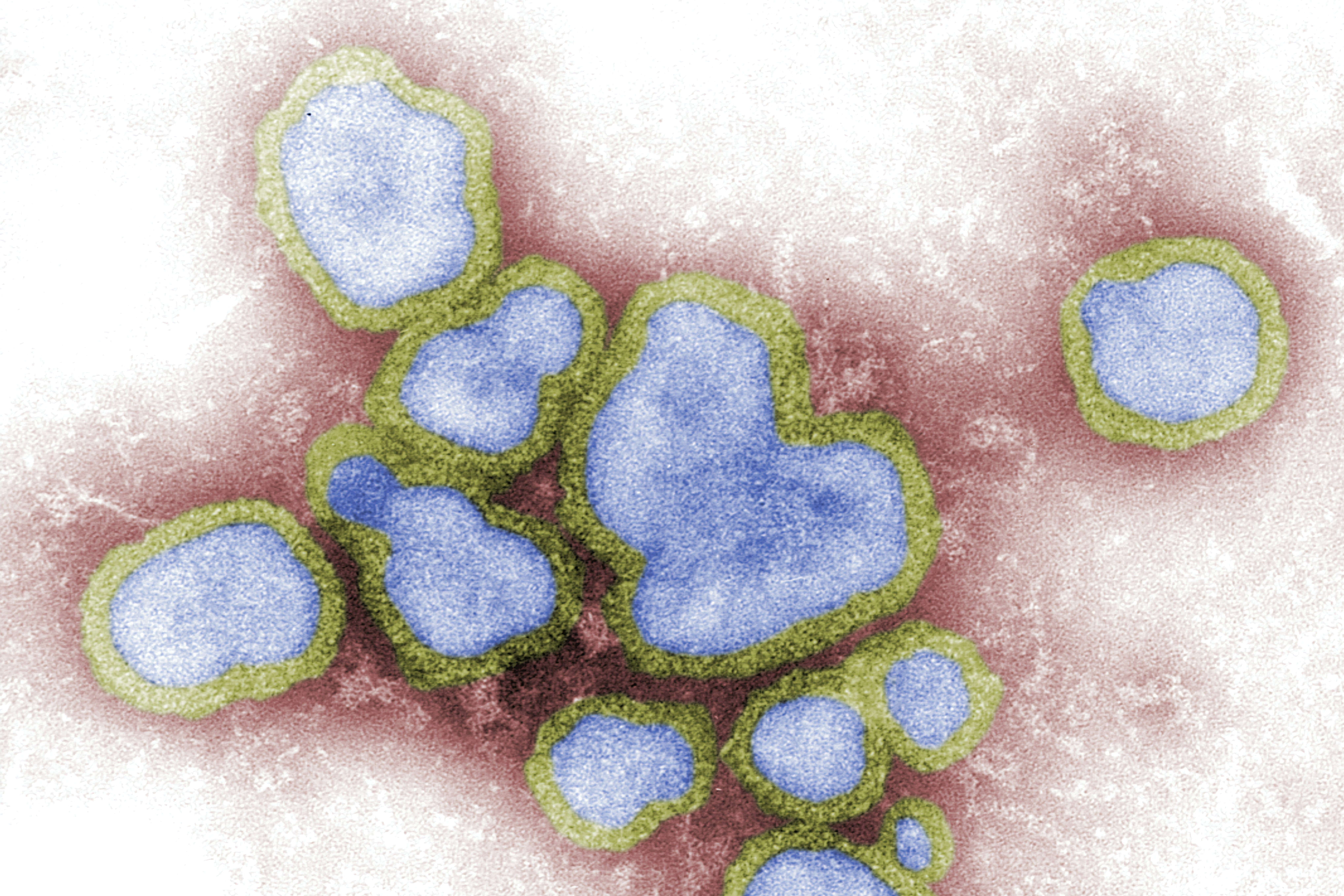 Trend of influenza infections in country stable — Health D-G