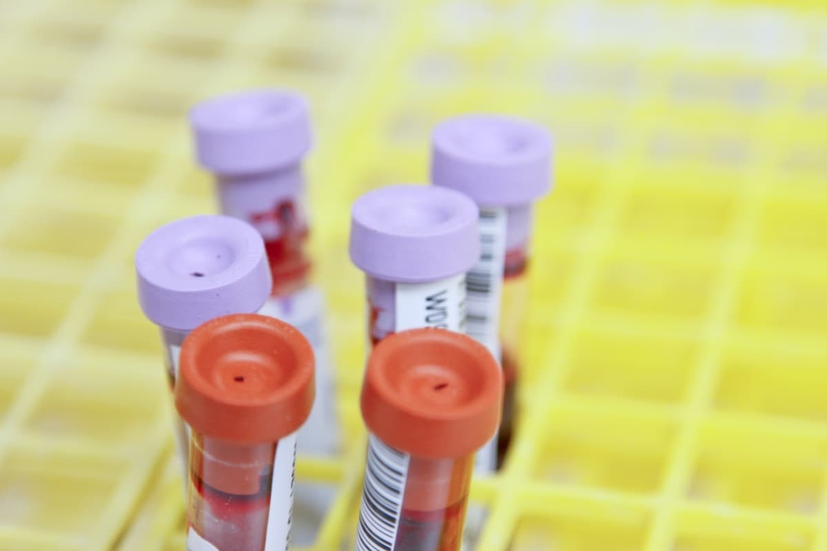 Health Ministry mulling proposal for blood donation at home