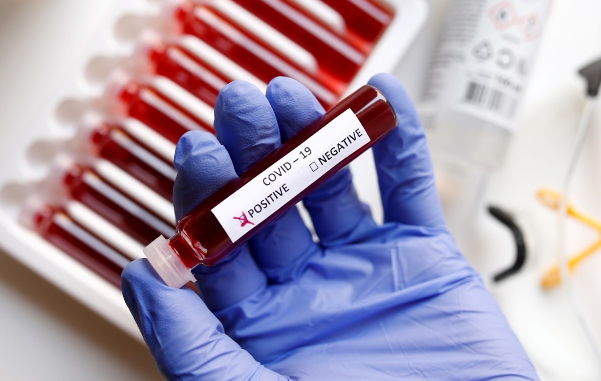 Risk of infection remains despite negative result, says MOH