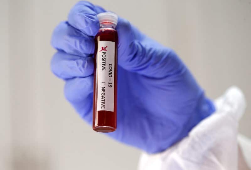 New study shows immunity drops quickly in mild Covid-19 cases