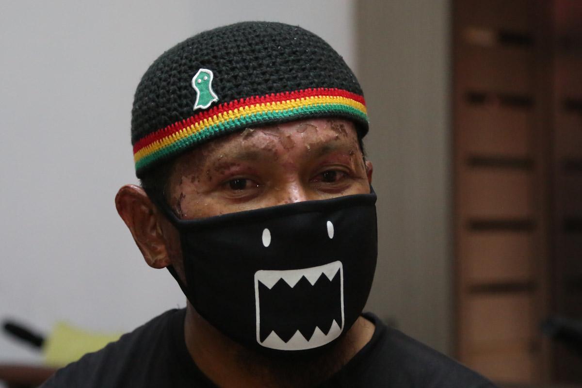 Alami masalah jantung, MBI bantu Ali XPDC