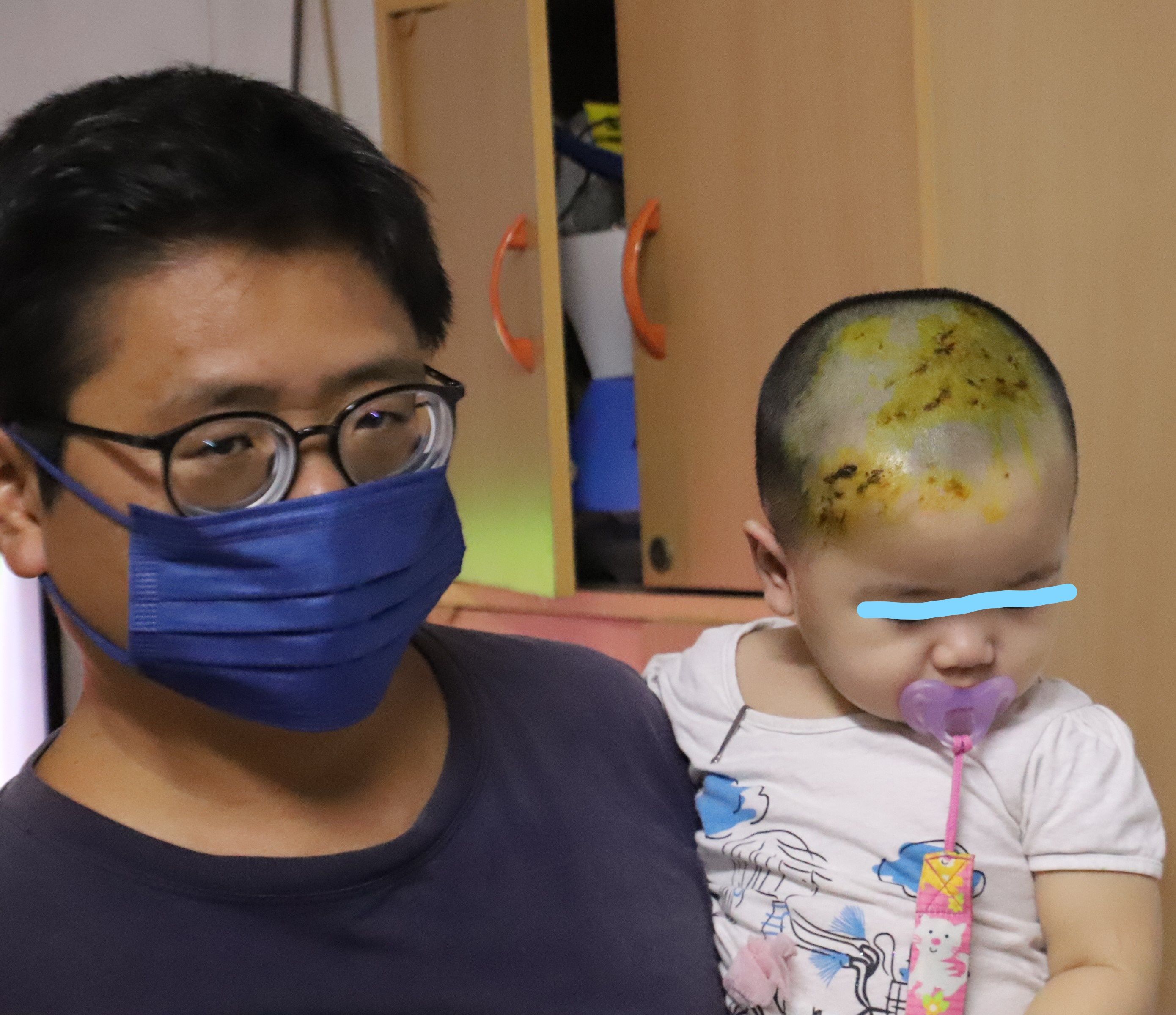 野猴屡闯民宅觅食捣乱 抓伤1岁童头部缝十多针