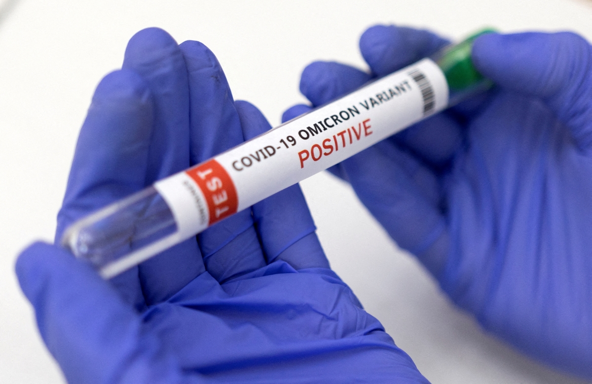 Number of Covid-19 cases expected to drop in January — Dr Dzulkefly