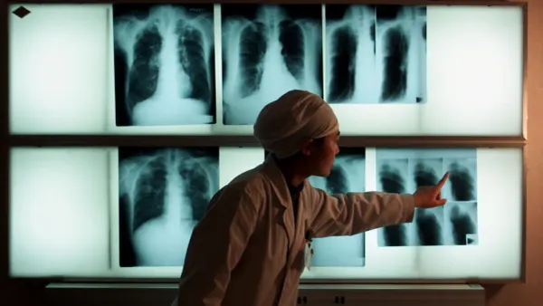 TB cluster detected in Kota Tinggi with 33 cases confirmed