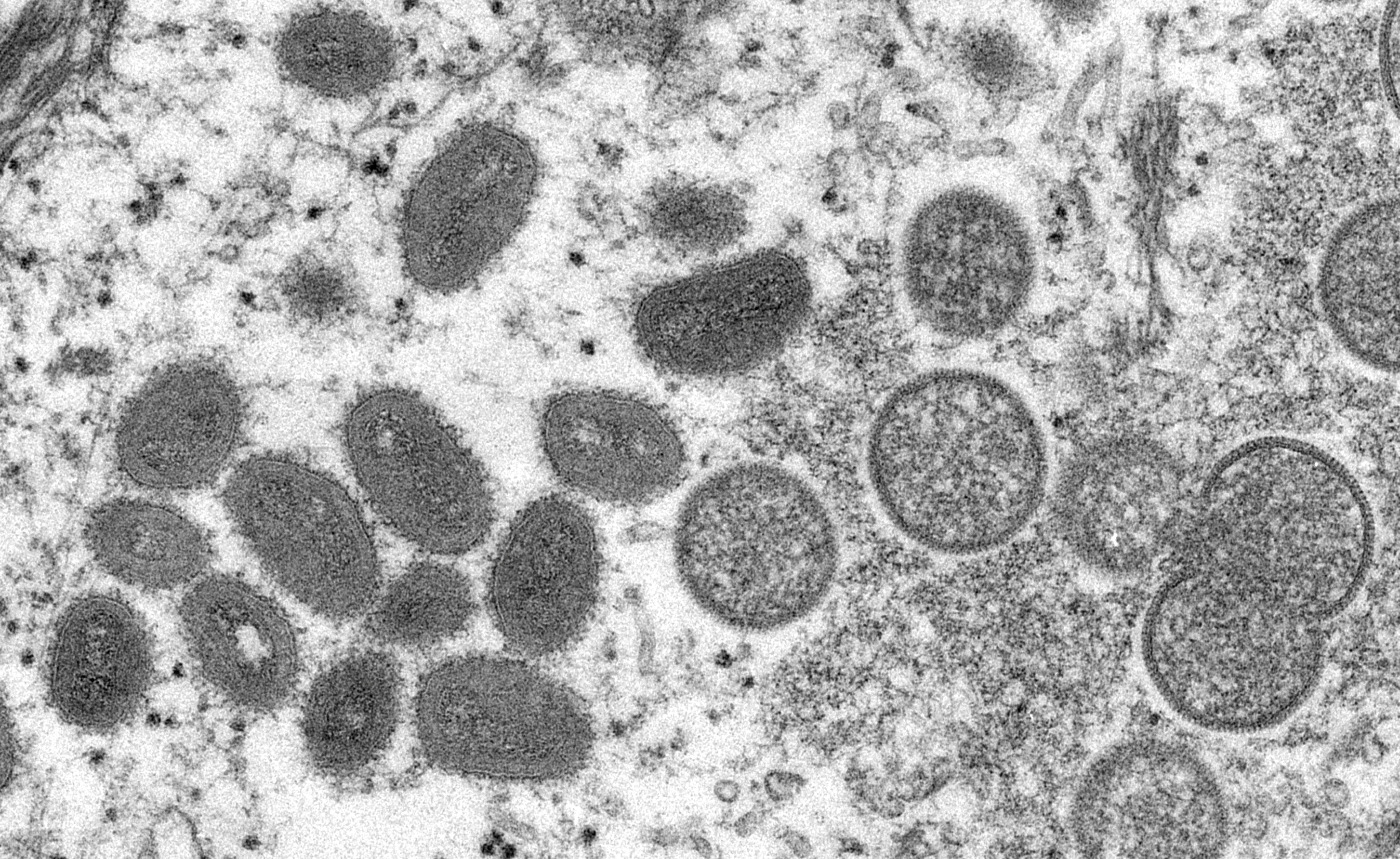 Monkeypox: Get vaccinated before travelling overseas — Expert