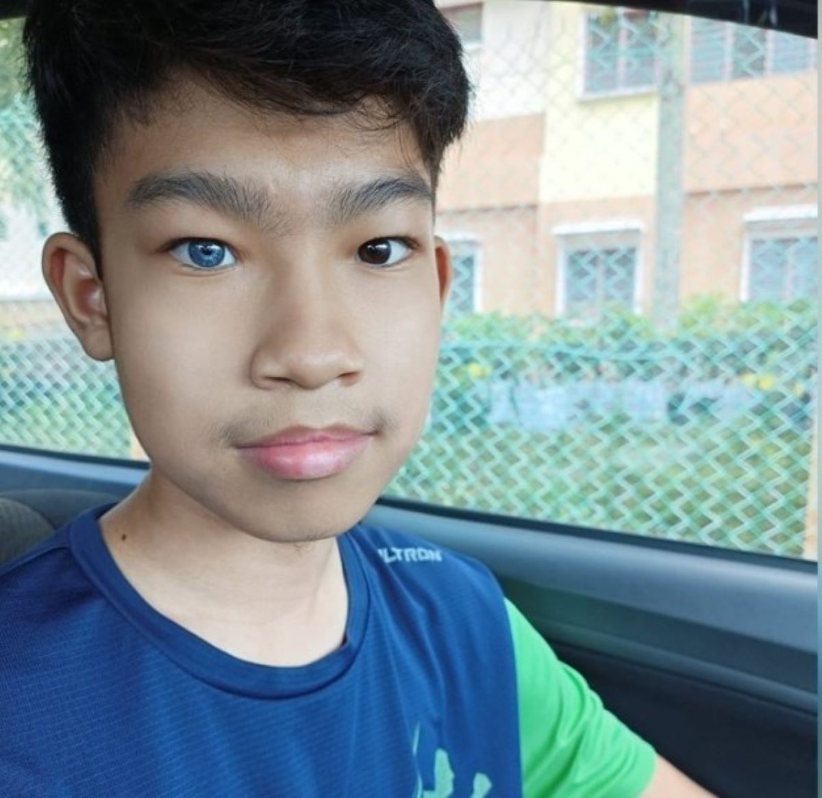 Heterokromia, keadaan perubatan unik dialami satu peratus populasi dunia