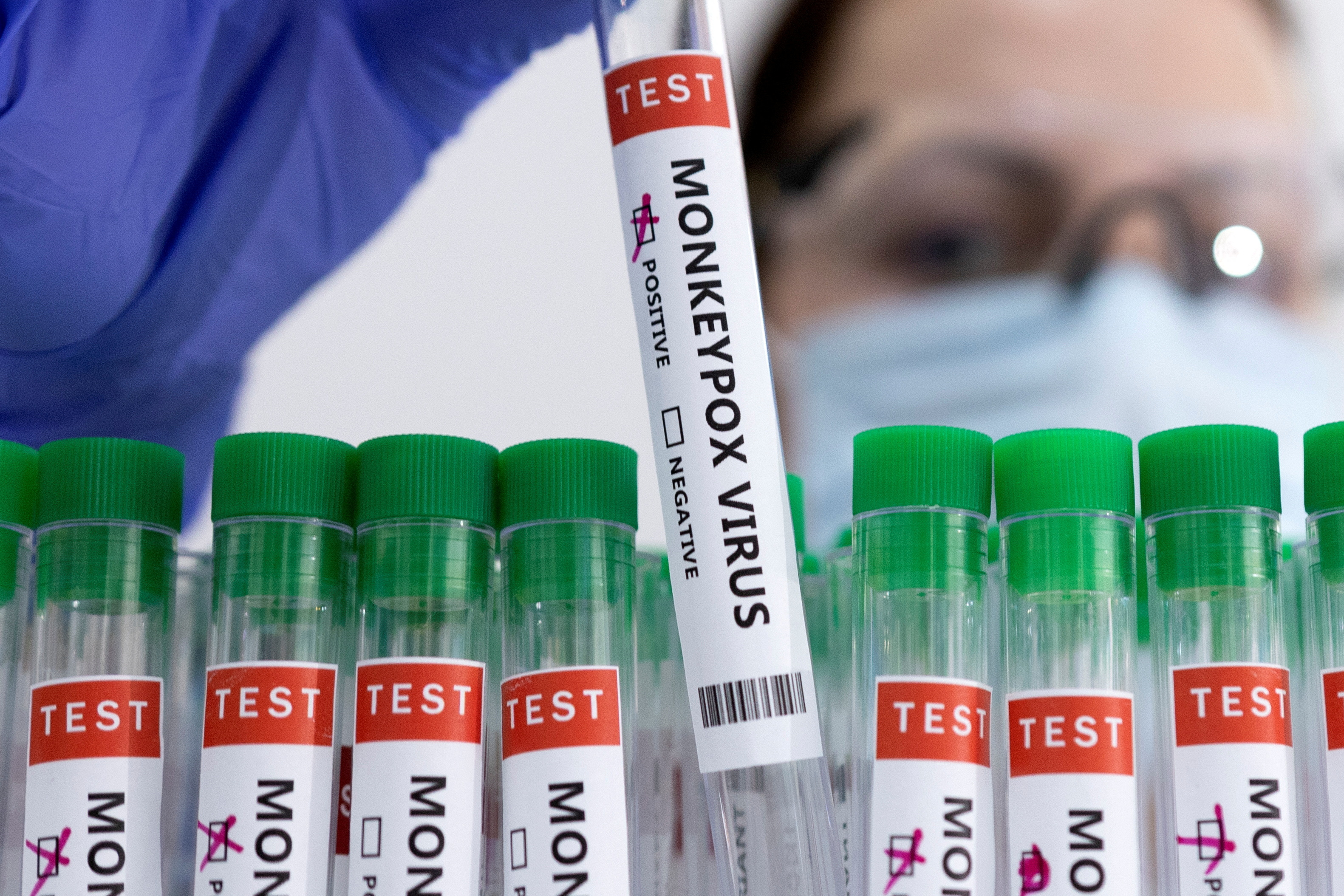 MOH intensifies screenings at borders to combat mpox spread