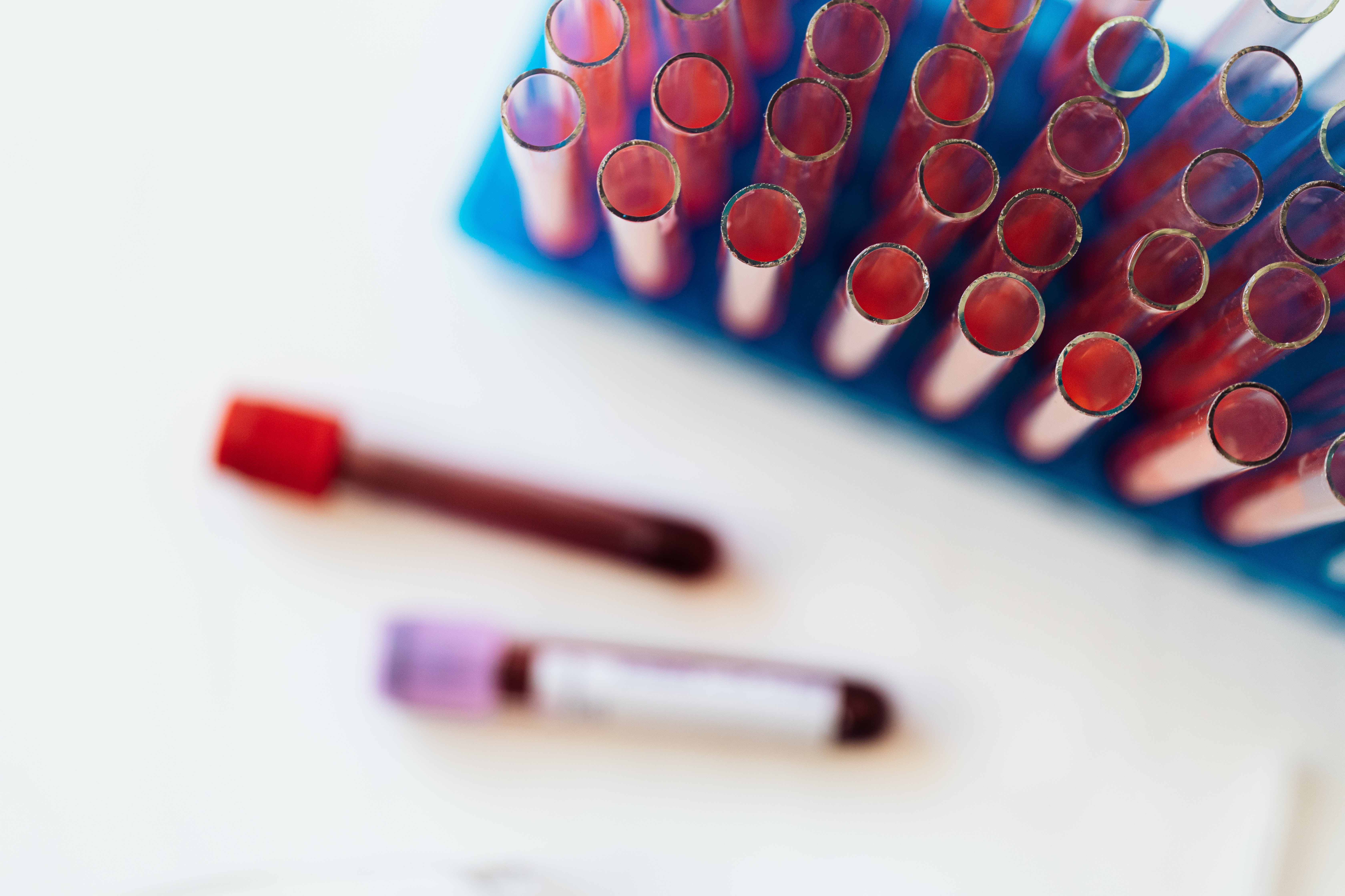 New HIV infections drop 70 pct in 20 years — Health Ministry