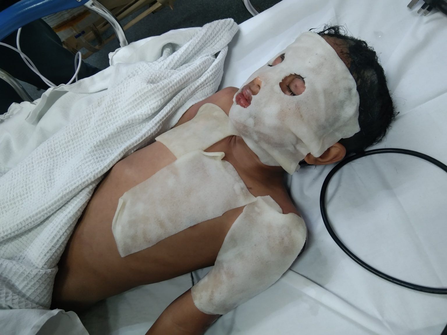 男子花50元买化学粉疏通水管 岂料爆炸灼伤楼下单位兄妹