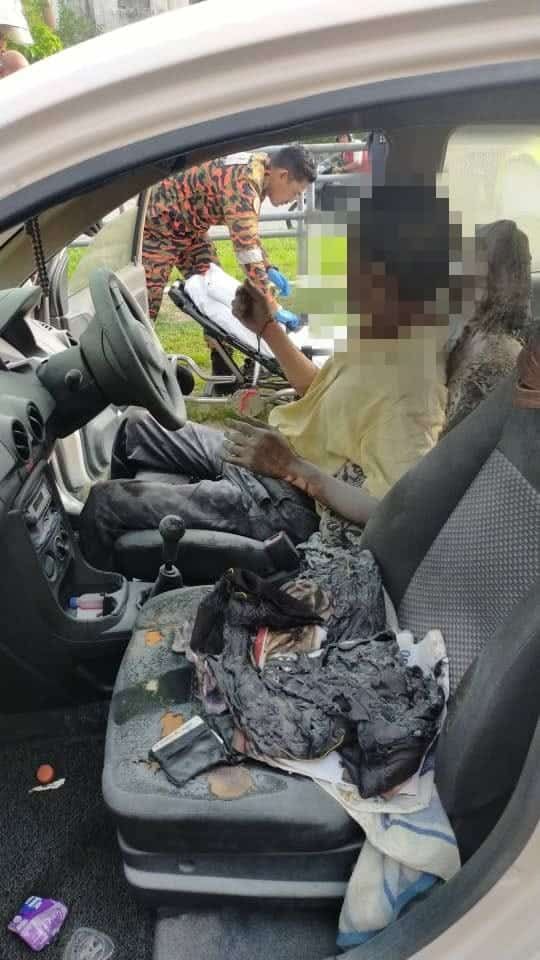 车内自焚寻死  老翁全身被烧伤70%