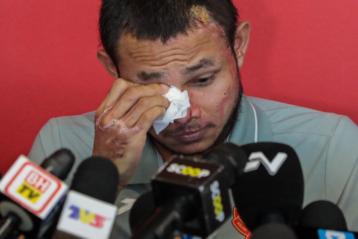100 hari kes simbah asid Faisal Halim, peminat menanti siasatan polis