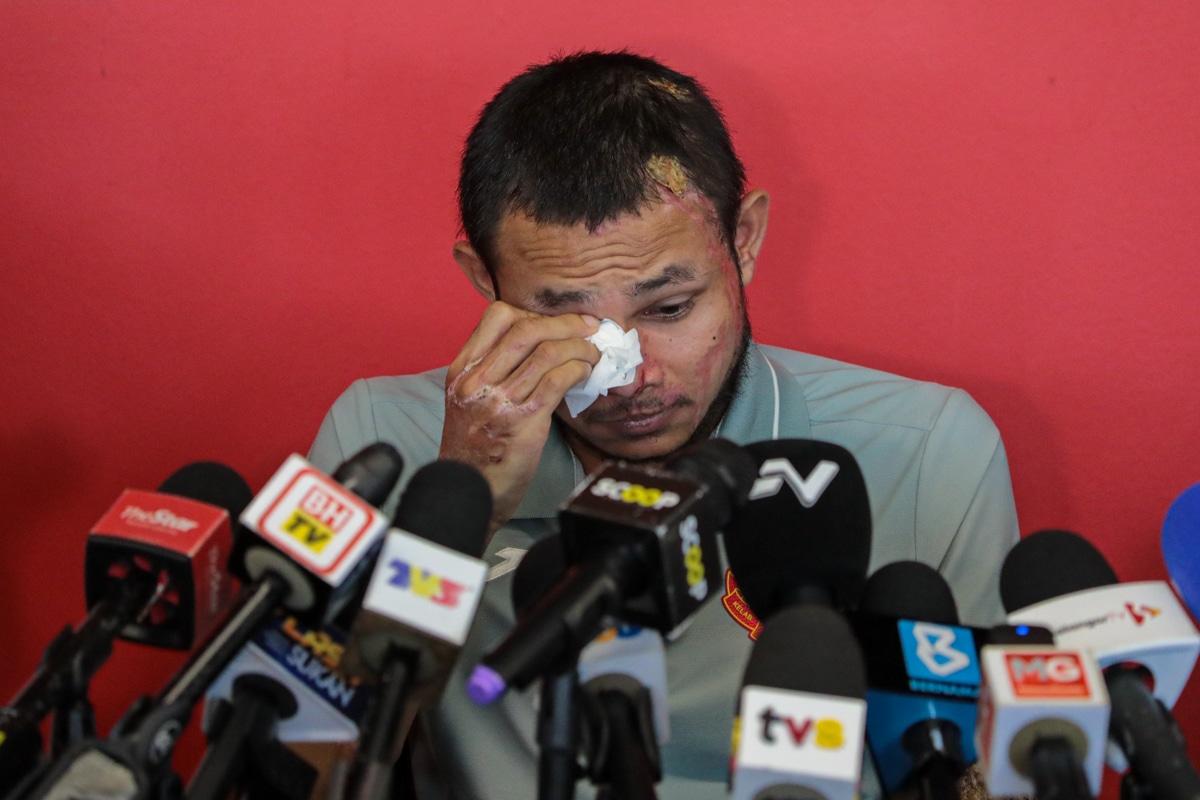 Faisal sebak cerita insiden simbahan asid, rindu pelukan anak