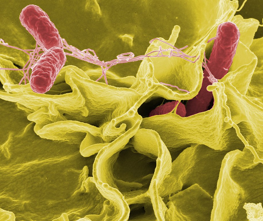 Gombak food poisoning: 11 salmonella infection victims stable