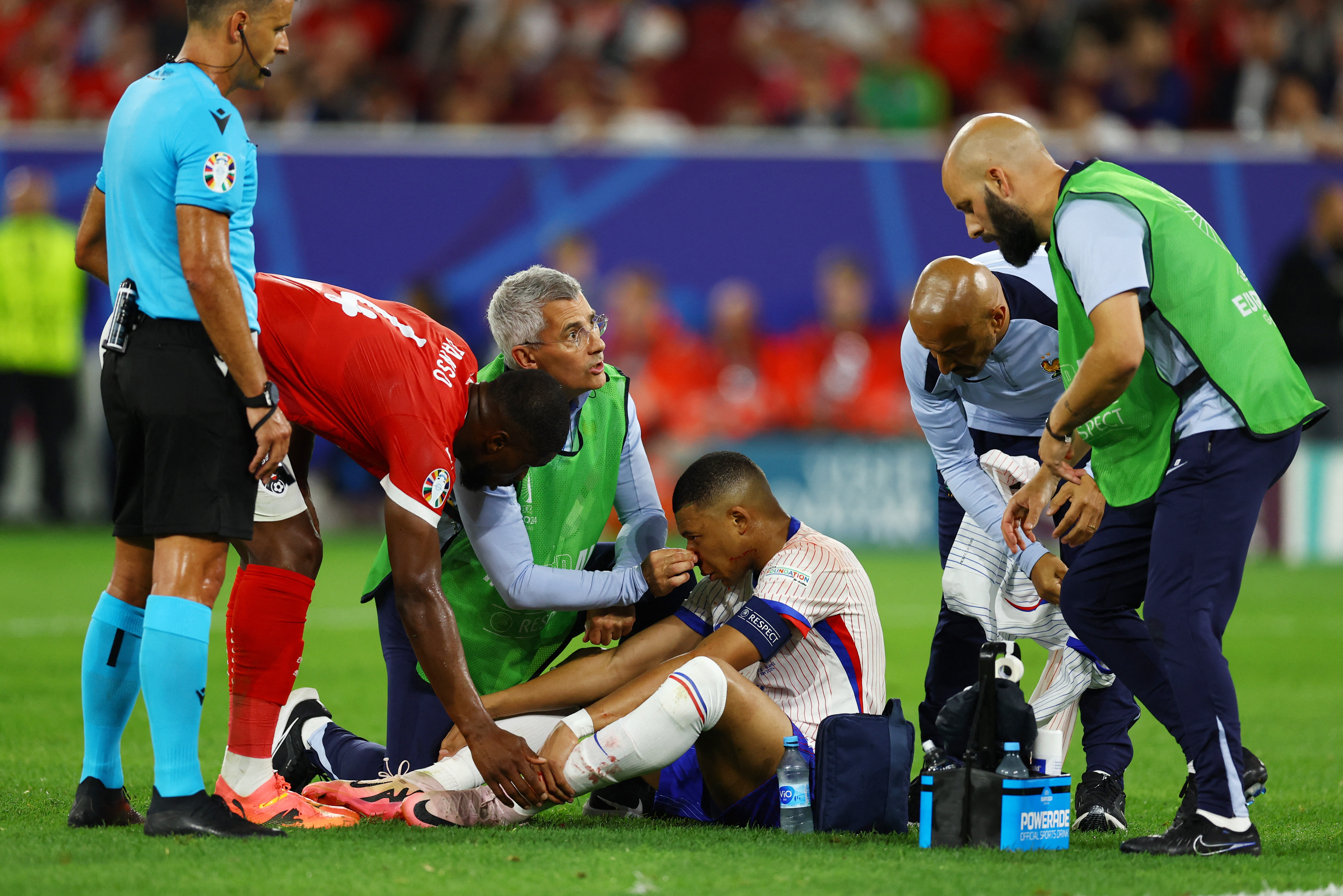 Mbappe breaks nose — a blow to France's Euro 2024 dreams