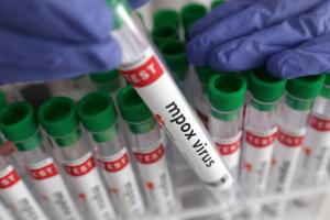Mpox deaths surpass 1,900 in Africa since 2024