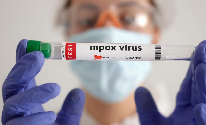Mpox: Police step up control at GOF posts to check virus spread