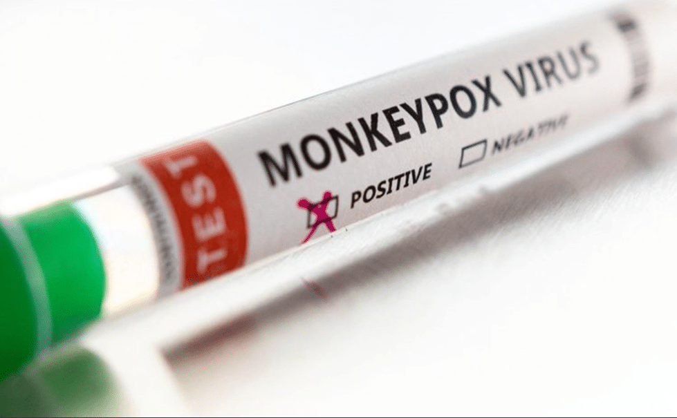 நாட்டில் உள்நாட்டவர் சம்பந்தப்பட்ட புதிய குரங்கம்மை சம்பவம் பதிவு