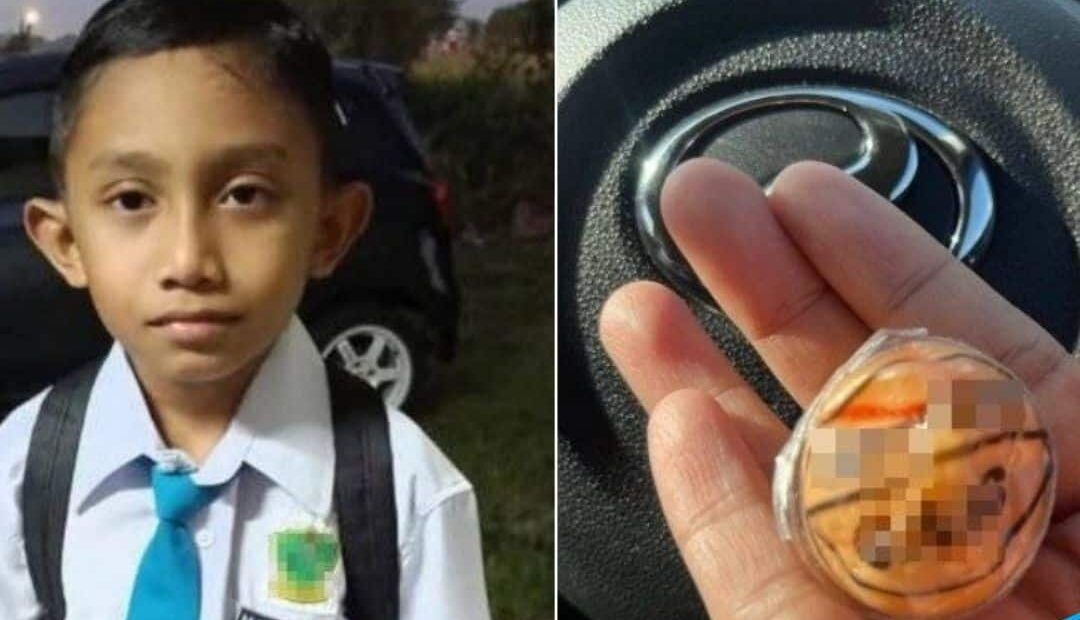 ‘கம்மி‘ மிட்டாய் தொண்டையில் சிக்கியது- பத்து வயது சிறுவன் ஆபத்தான நிலையில் அனுமதி