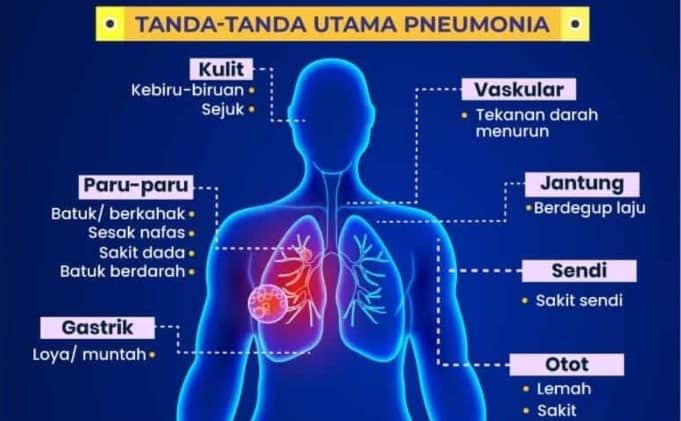 Bukan sekadar selesema, pneumonia kini punca utama kematian di Malaysia