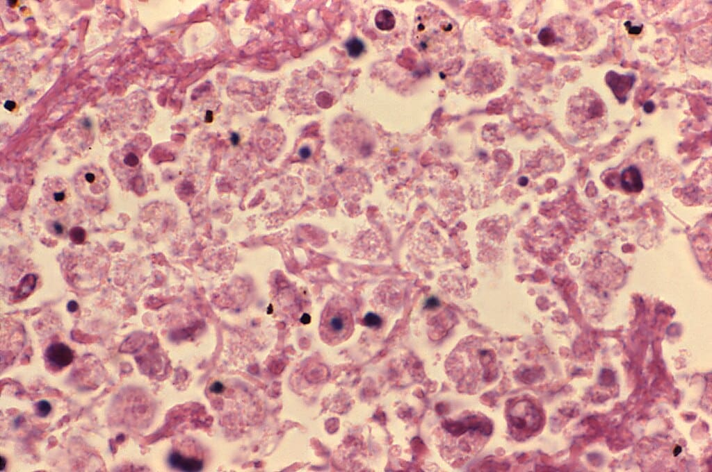 Health Ministry monitoring Legionnaires’ outbreak in Sydney, no cases reported in Malaysia