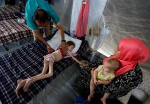 Famine plays out in Palestine as kids denied food supplements