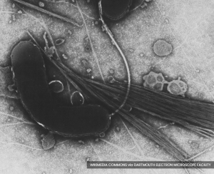 WHO warns of severe global cholera outbreak