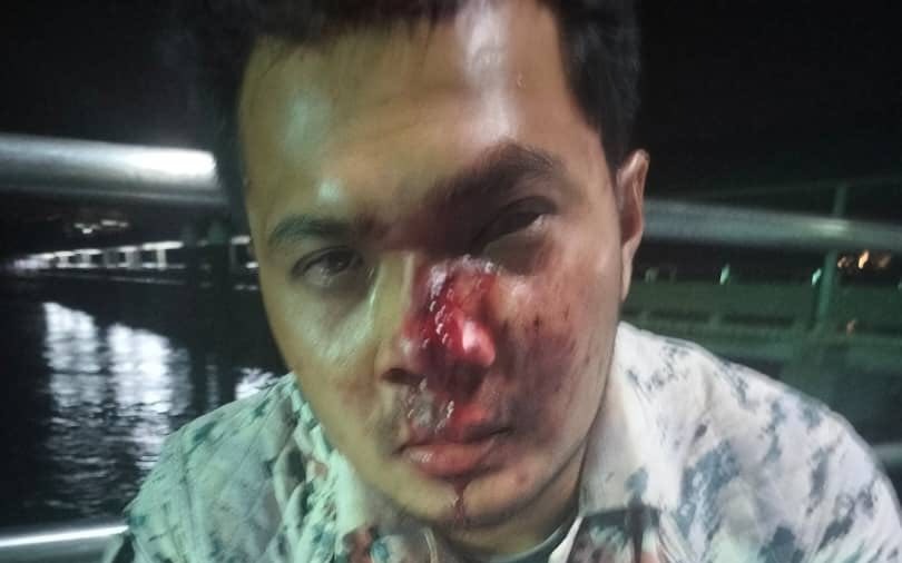 Dua anggota maritim cedera dirempuh bot pancung bawa pendatang asing