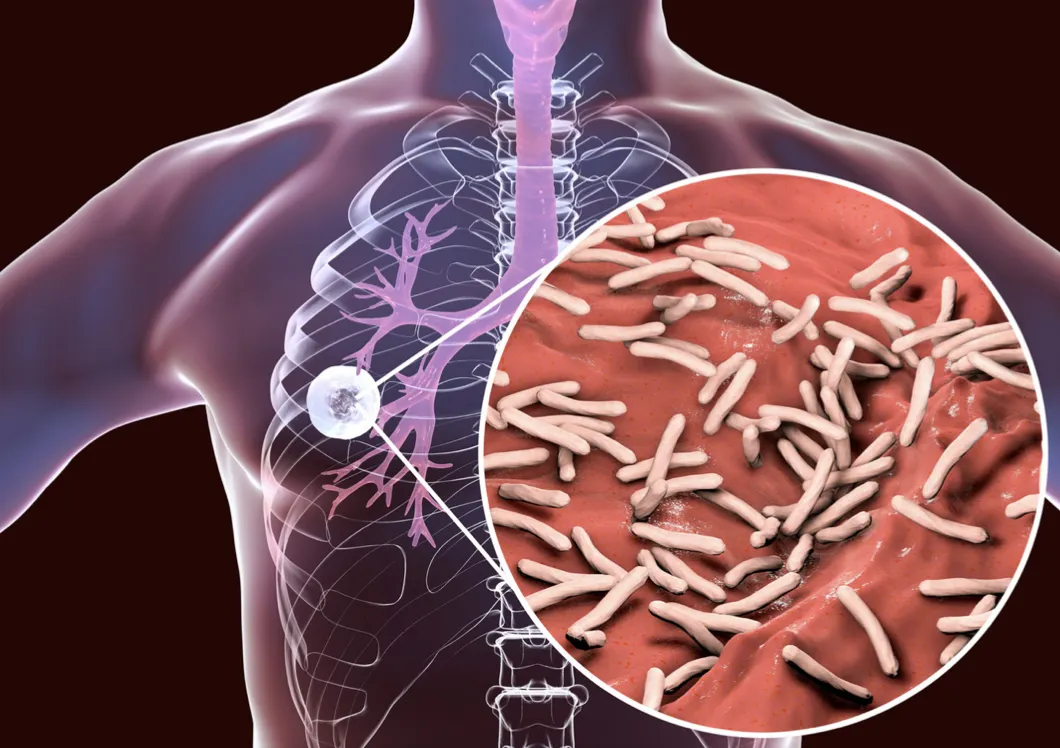 Penyelidik Australia temui mekanisme antibiotik tibi baharu