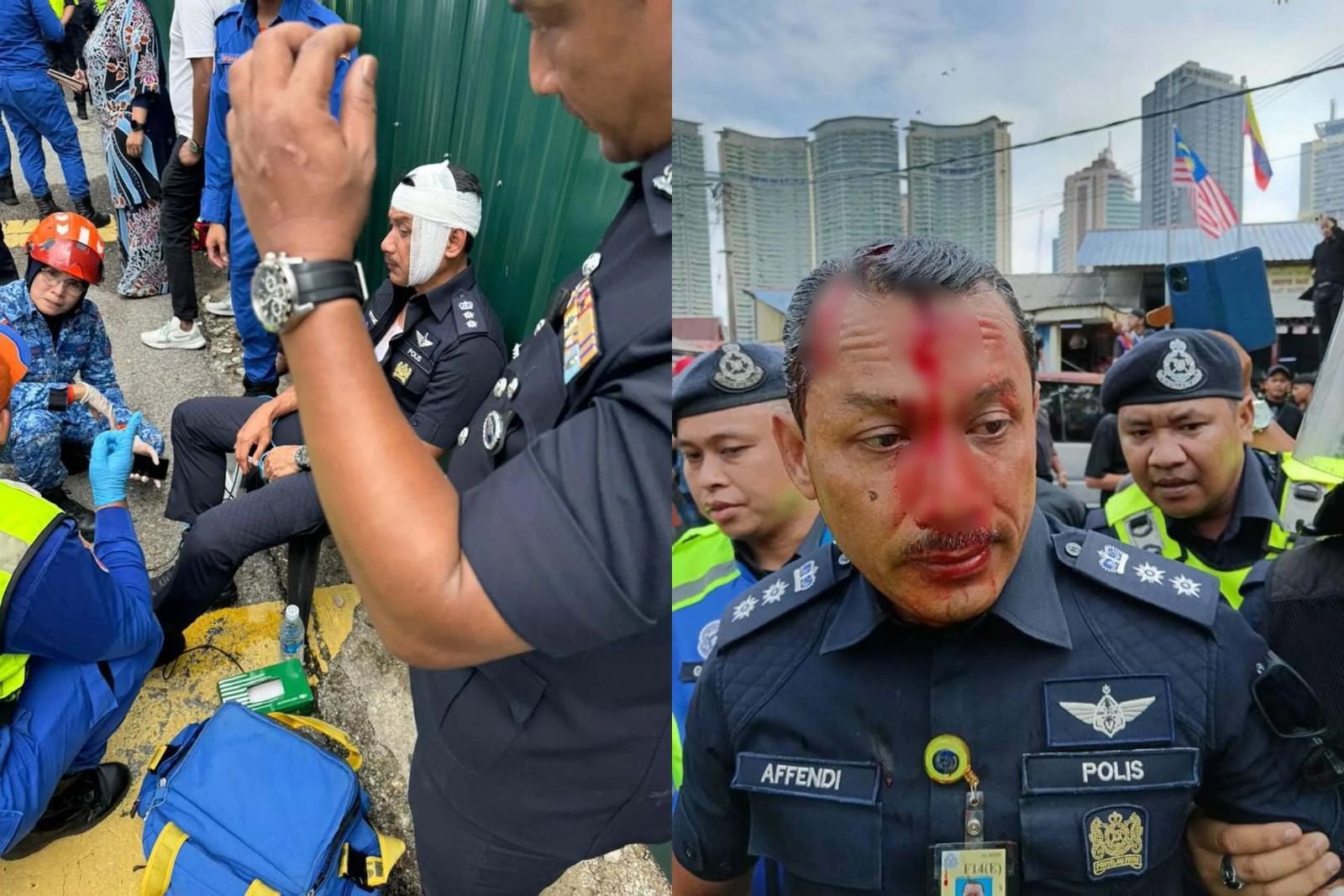 Teen gets 100 hours of community service for hurting Dang Wangi police ex-chief