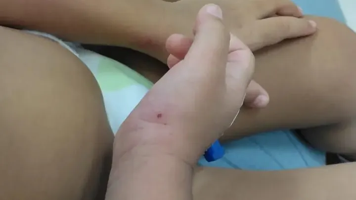 Serangan anjing liar berulang, ADN gesa tindakan tegas